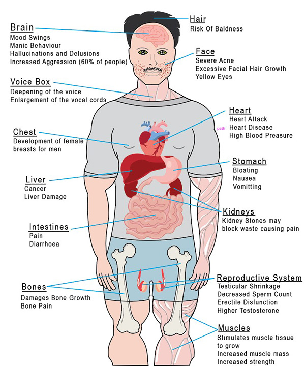 steroidsideeffects.jpg